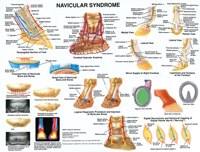 Navicular Syndrome Chart